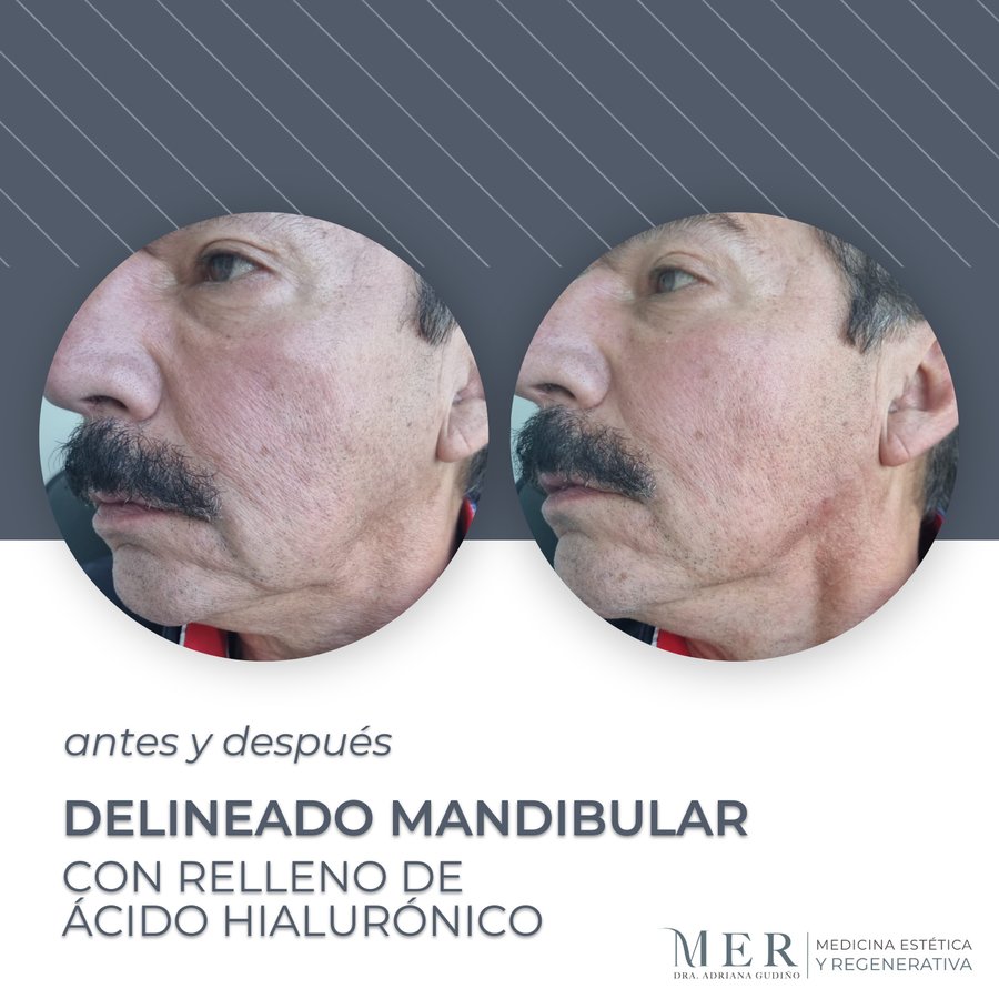 Medicina Estética Regenerativa - Medicina Estética Regenerativa