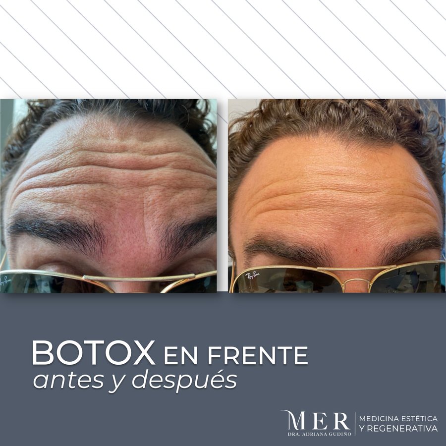 Medicina Estética Regenerativa - Medicina Estética Regenerativa