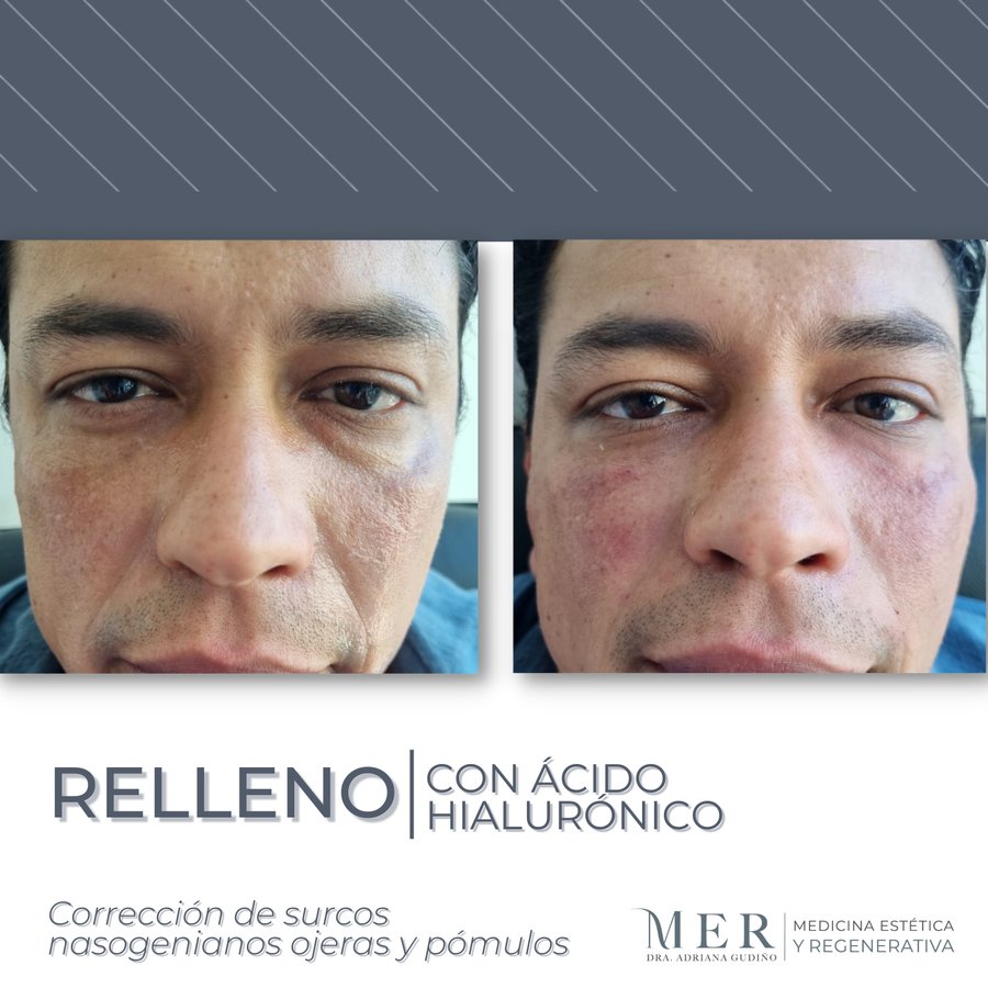 Medicina Estética Regenerativa - Medicina Estética Regenerativa