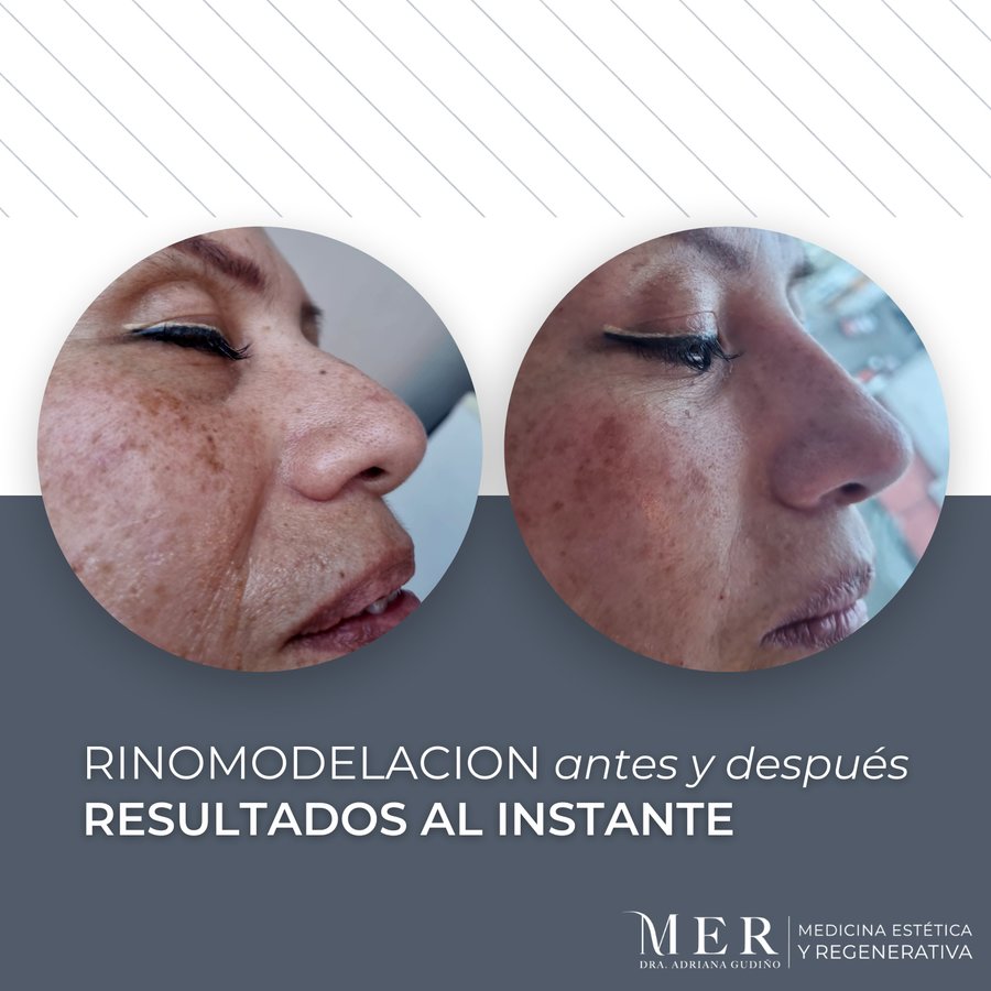 Medicina Estética Regenerativa - Medicina Estética Regenerativa