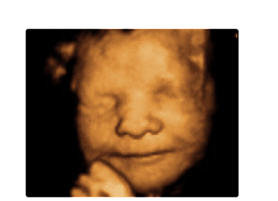 Ecografía 3D y 4D en Medellín - Ecografía 3D y 4D en Medellín