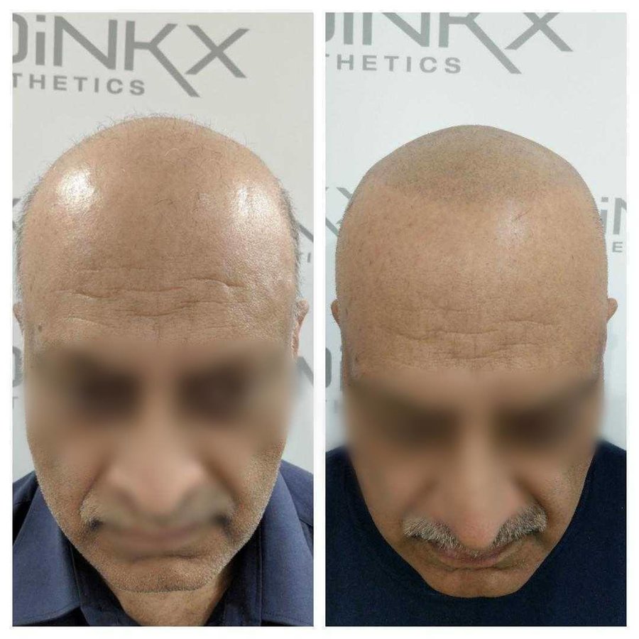 ميدينكس للتجميل - Medinkx Aesthetics