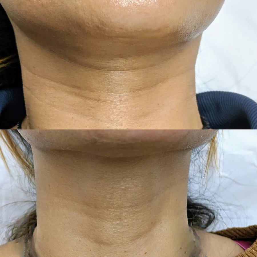 ميدينكس للتجميل - Medinkx Aesthetics