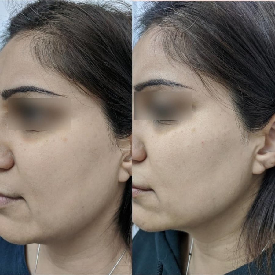 ميدينكس للتجميل - Medinkx Aesthetics