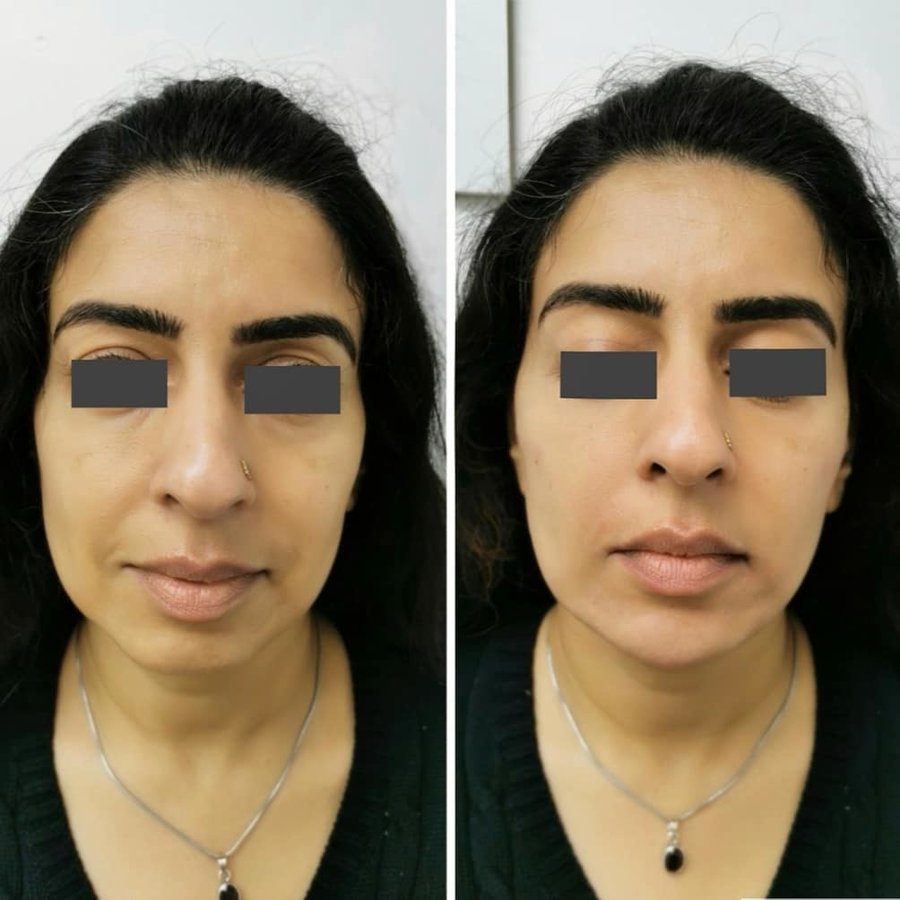 ميدينكس للتجميل - Medinkx Aesthetics