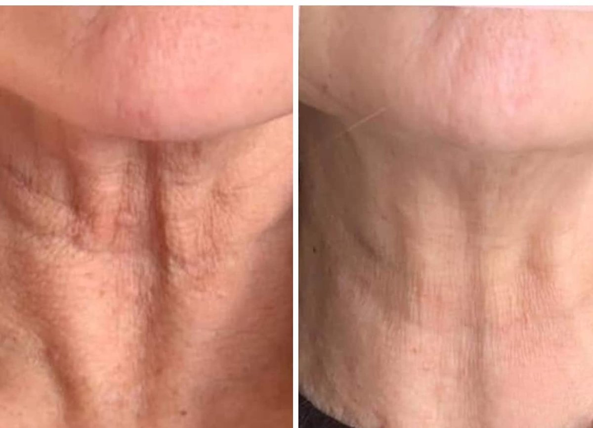 ميدينكس للتجميل - Medinkx Aesthetics