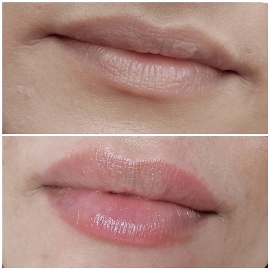 ميدينكس للتجميل - Medinkx Aesthetics