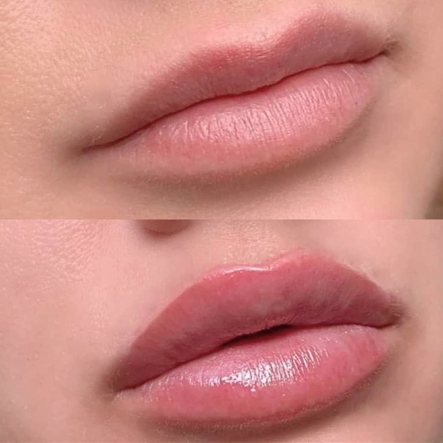 ميدينكس للتجميل - Medinkx Aesthetics