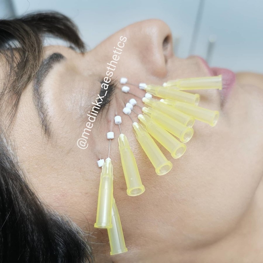 ميدينكس للتجميل - Medinkx Aesthetics