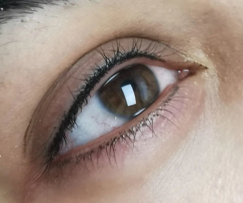 ميدينكس للتجميل - Medinkx Aesthetics