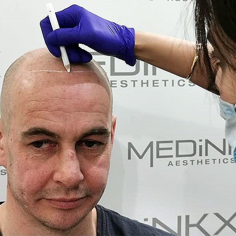 ميدينكس للتجميل - Medinkx Aesthetics