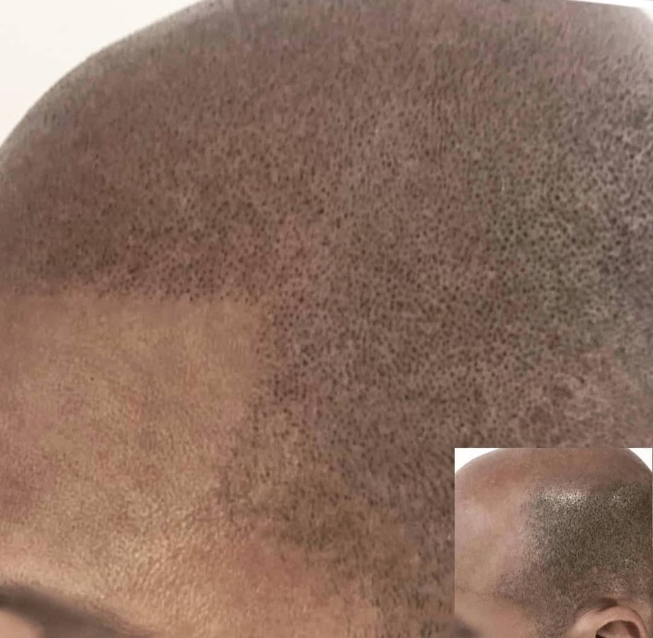 ميدينكس للتجميل - Medinkx Aesthetics