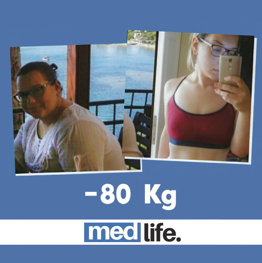 Medlife Group - Bariatric - Medlife Group - Bariatric