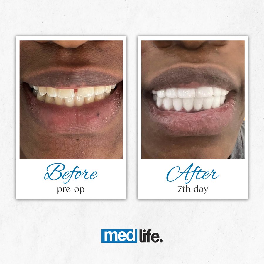 Medlife Group - طبيب أسنان ديديم - Medlife Group - Dentist Didim