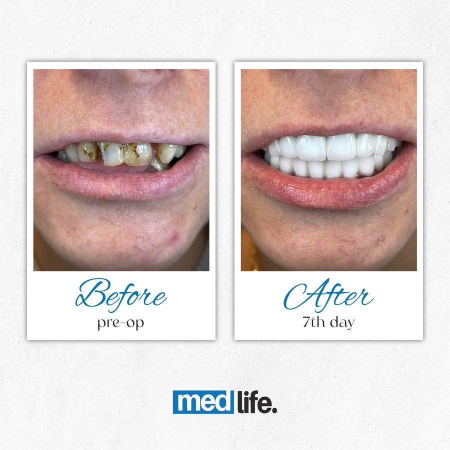 Medlife Group - Dentist Urla - Medlife Group - Dentist Urla