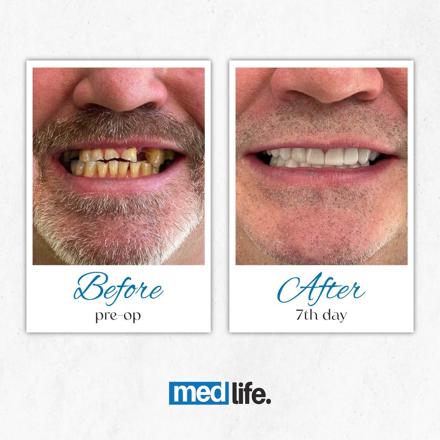 Medlife Group - Dentist Urla - Medlife Group - Dentist Urla