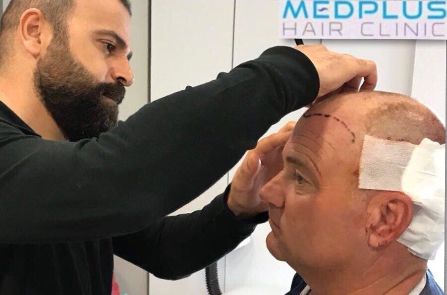 MedPlus Hair Clinic Turkey - MedPlus Hair Clinic Turkey