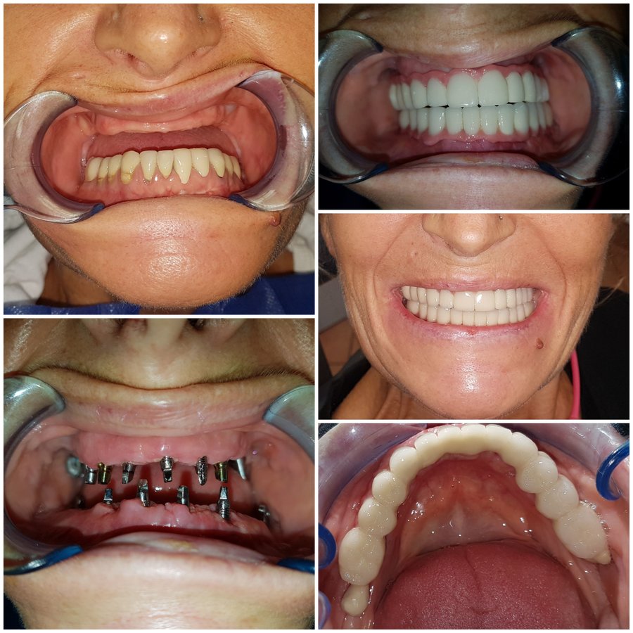 Medstom Dental Clinic Dondukov - Medstom Dental Clinic Dondukov