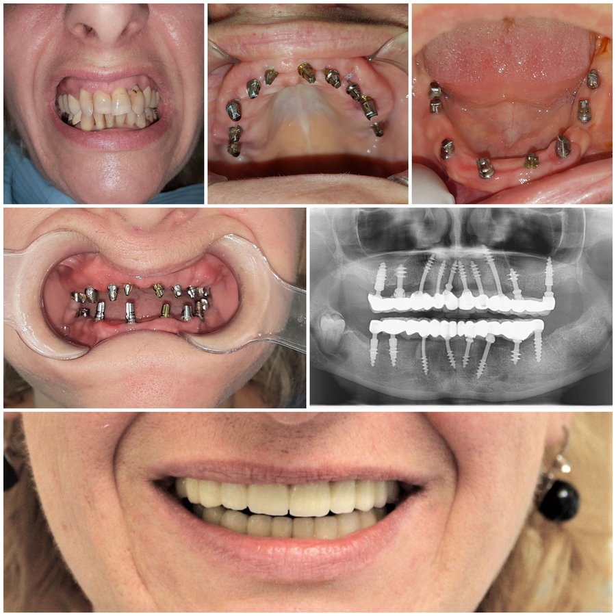 Medstom Dental Clinic Dondukov - Medstom Dental Clinic Dondukov