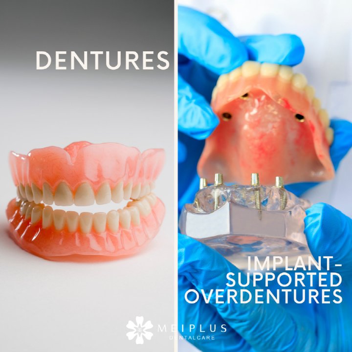 Meiplus Dentalcare - Meiplus Dentalcare