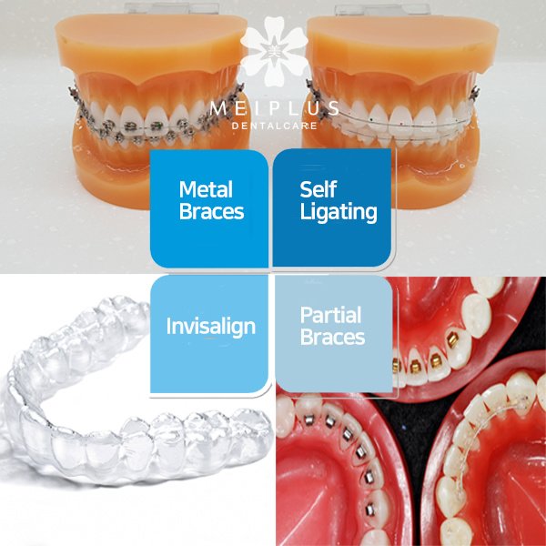 Meiplus Dentalcare-فرع تيلوك آير - Meiplus Dentalcare-Telok Ayer Branch
