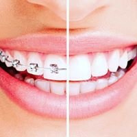 Melilla Dental Clinic - Melilla Dental Clinic