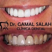 Melilla Dental Clinic - Melilla Dental Clinic