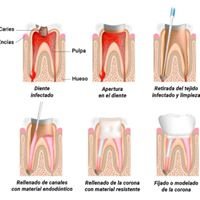 Melilla Dental Clinic - Melilla Dental Clinic