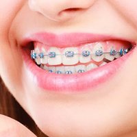 Melilla Dental Clinic - Melilla Dental Clinic