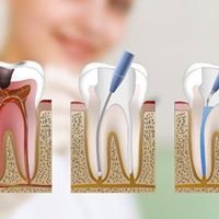 Melilla Dental Clinic - Melilla Dental Clinic