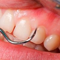 Melilla Dental Clinic - Melilla Dental Clinic