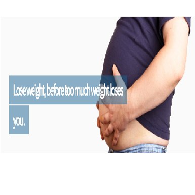 جراحة الأيض والسمنة - Metabolic and Obesity Surgery