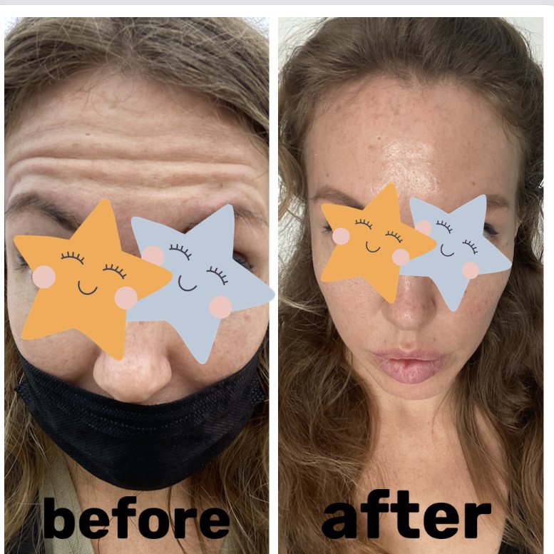 Metro Beauty Centers - Metro Beauty Centers