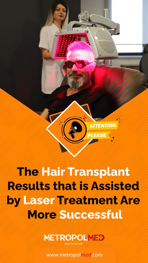 Metropol Med Hair Transplant - Metropol Med Hair Transplant