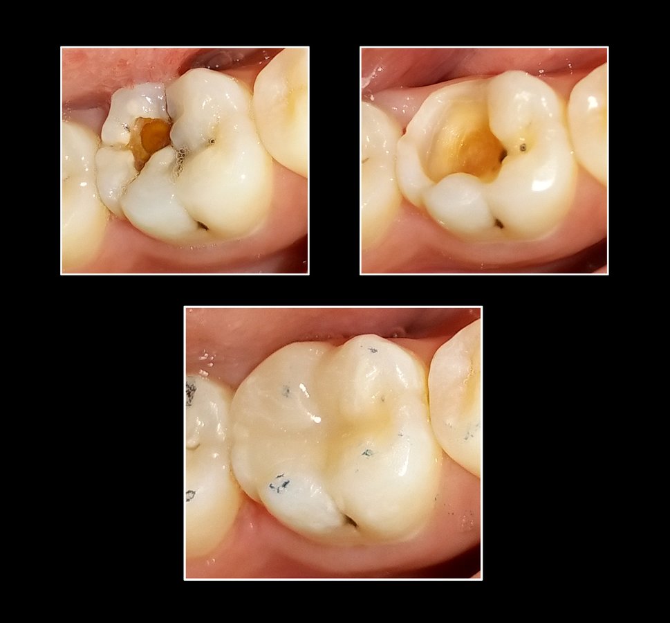 Metropolis Dental Surabaya - Metropolis Dental Surabaya