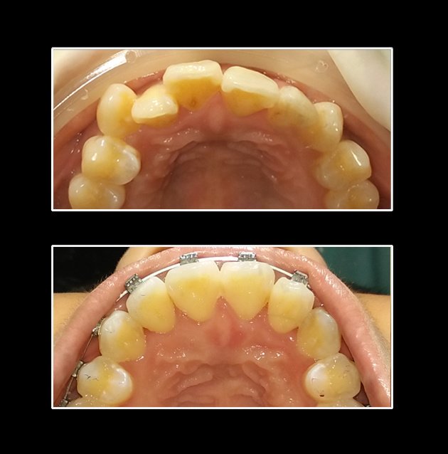 Metropolis Dental Surabaya - Metropolis Dental Surabaya