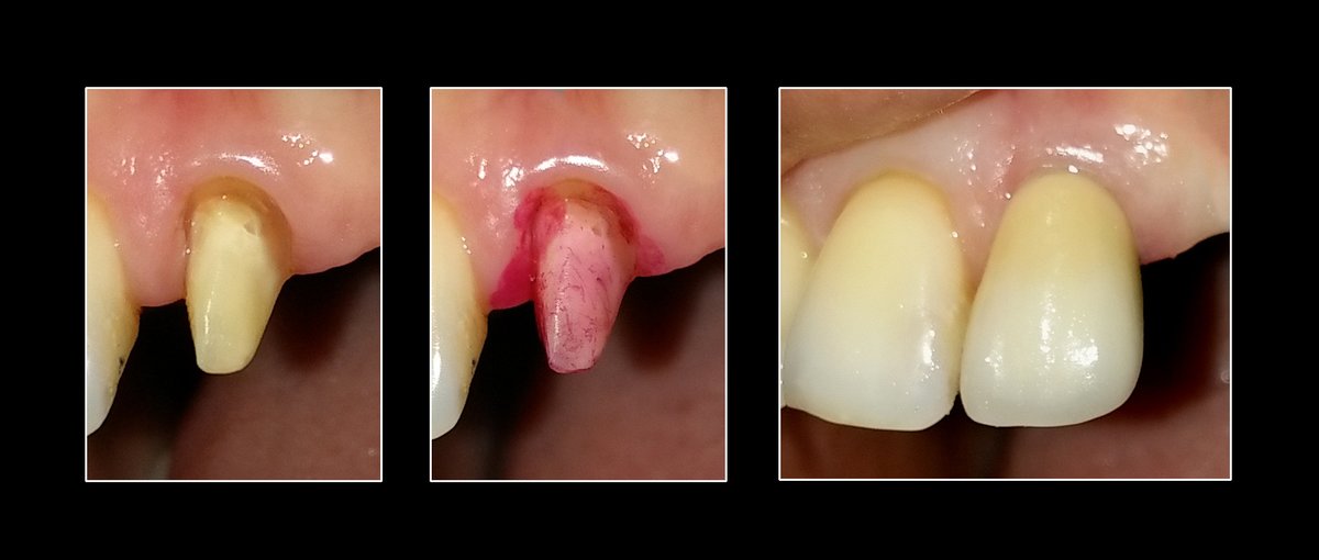 Metropolis Dental Surabaya - Metropolis Dental Surabaya