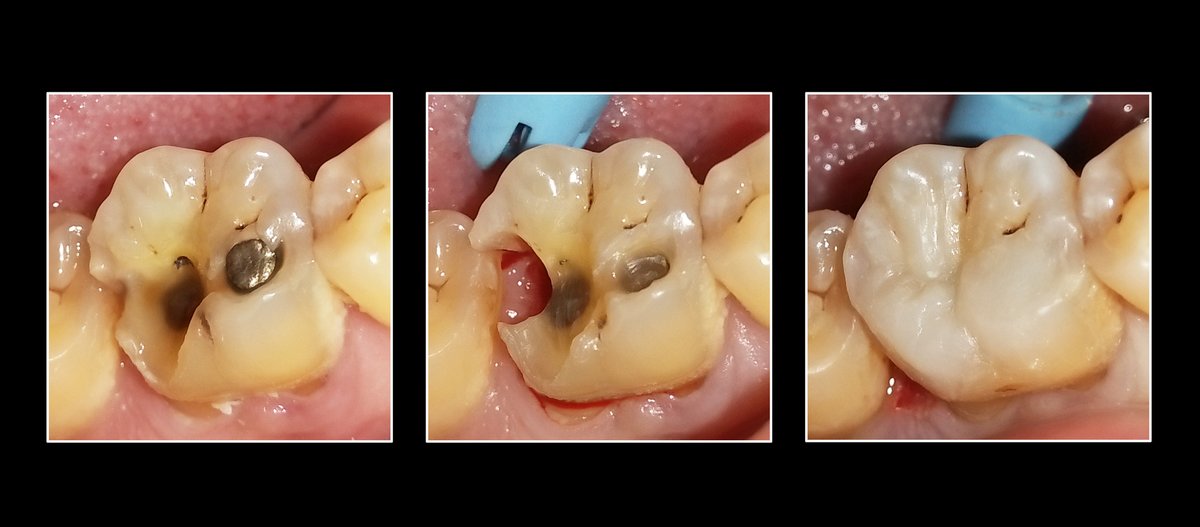 Metropolis Dental Surabaya - Metropolis Dental Surabaya