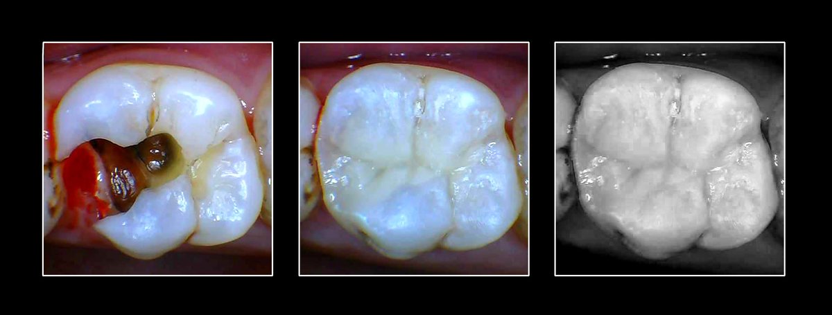 Metropolis Dental Surabaya - Metropolis Dental Surabaya