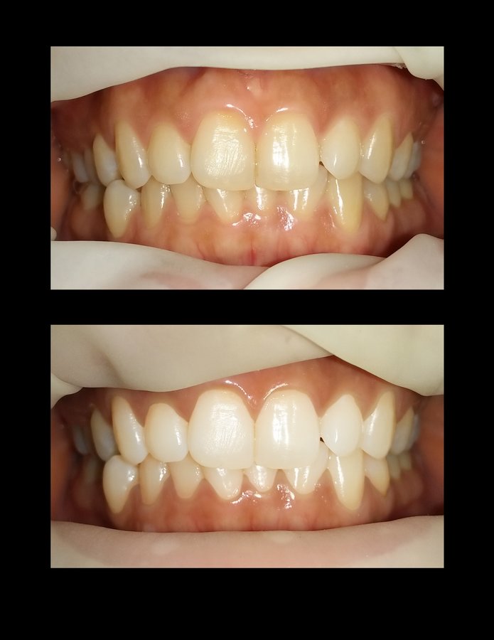 Metropolis Dental Surabaya - Metropolis Dental Surabaya