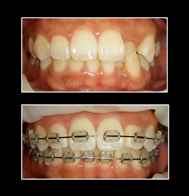 Metropolis Dental Surabaya - Metropolis Dental Surabaya