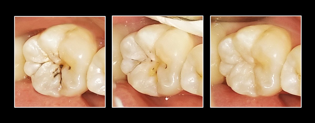 Metropolis Dental Surabaya - Metropolis Dental Surabaya