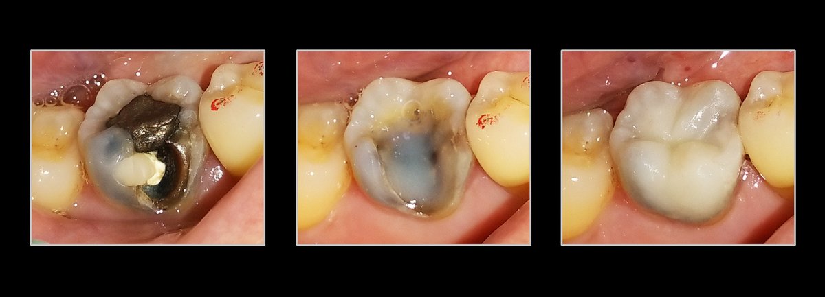 Metropolis Dental Surabaya - Metropolis Dental Surabaya