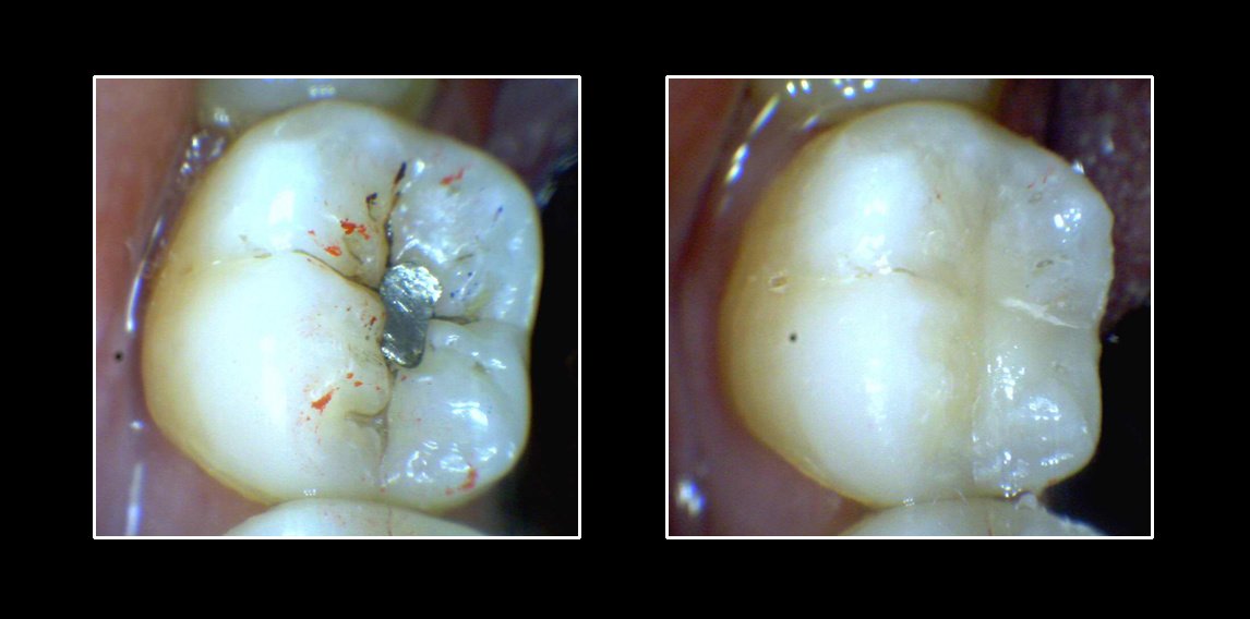 Metropolis Dental Surabaya - Metropolis Dental Surabaya