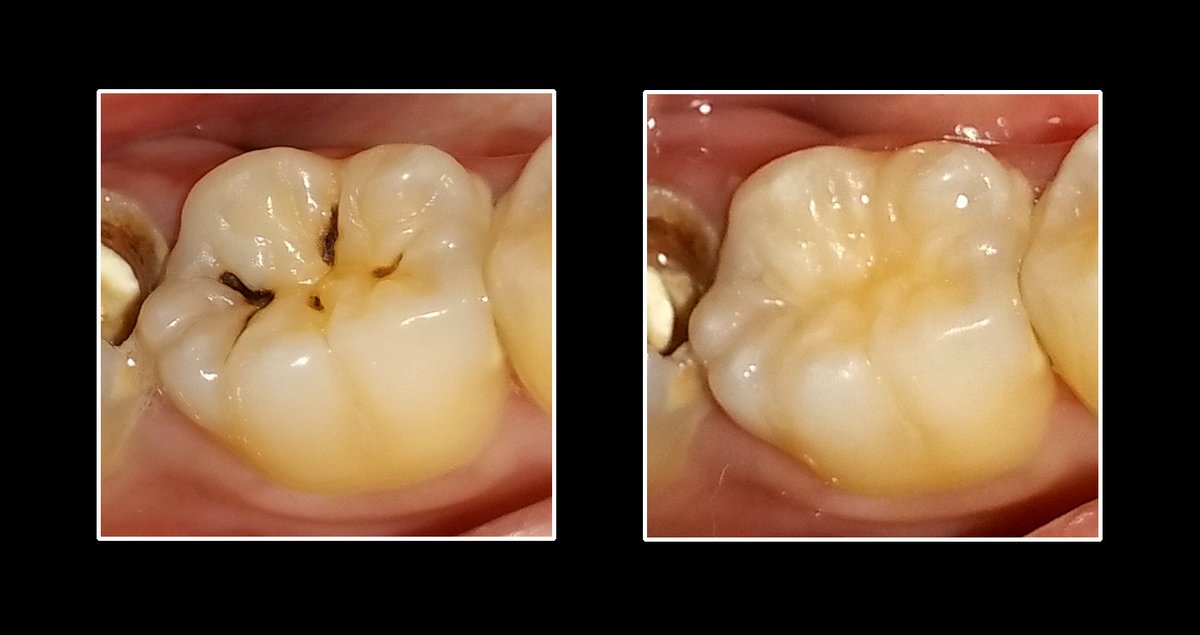Metropolis Dental Surabaya - Metropolis Dental Surabaya