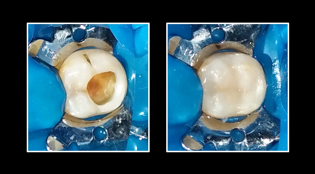 Metropolis Dental Surabaya - Metropolis Dental Surabaya