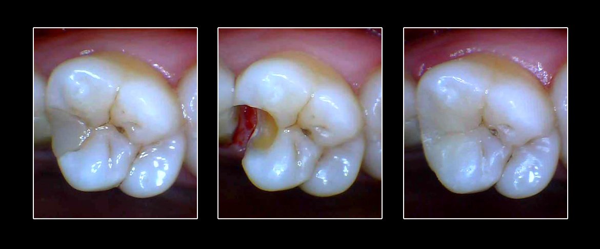 Metropolis Dental Surabaya - Metropolis Dental Surabaya