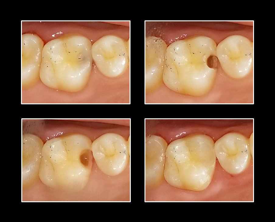 Metropolis Dental Surabaya - Metropolis Dental Surabaya