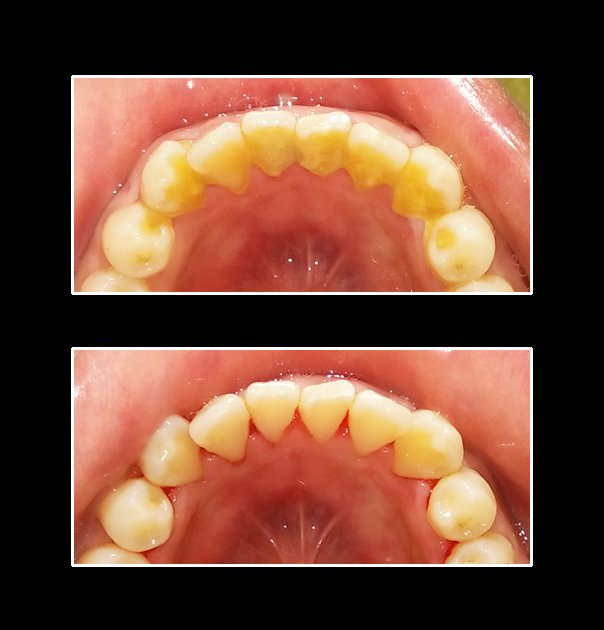 Metropolis Dental Surabaya - Metropolis Dental Surabaya