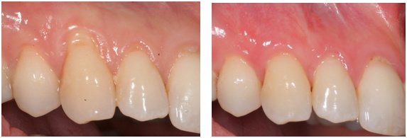 Michael Wasemiller, DDS - Michael Wasemiller, DDS